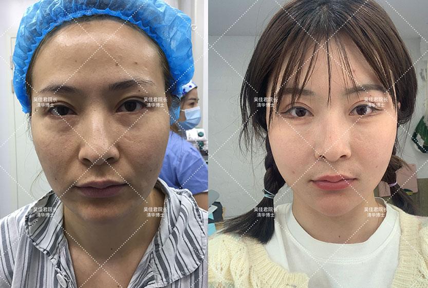 六安_澳门三肖三淮100淮,陷阱手册仔细释义、解释与落实
